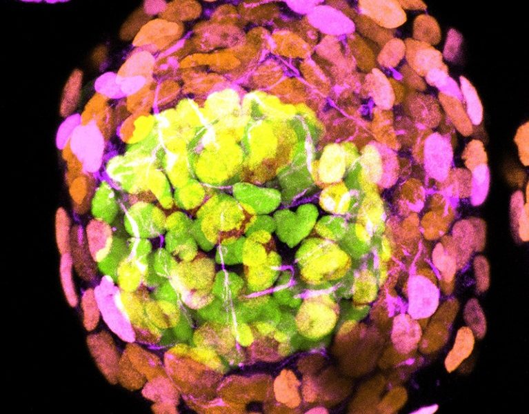 Most advanced synthetic human embryos yet spark controversy